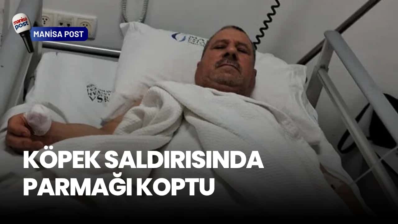 Sarıgöl’de Köpek Saldırısı: Bir Vatandaşın Parmağı Koptu