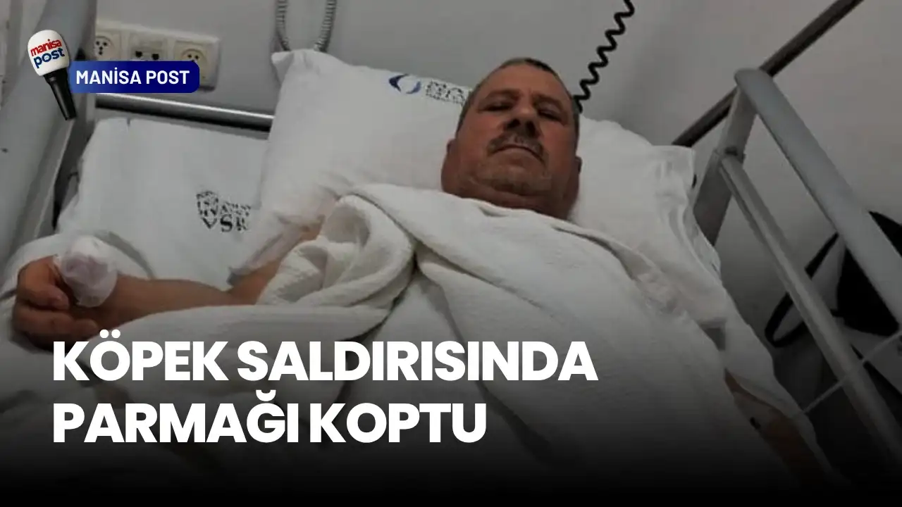 Sarıgöl’de Köpek Saldırısı: Bir Vatandaşın Parmağı Koptu